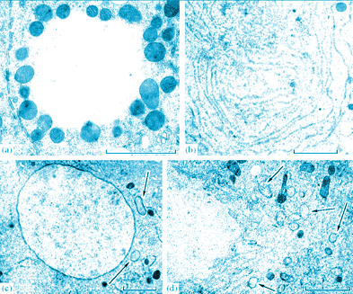 <i>Wolbachia</i> ‘popcorn’ strain is discovered <i>Wolbachia</i> ‘popcorn’ strain is discovered